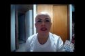 Alopecia Areata saludo para Shanovi